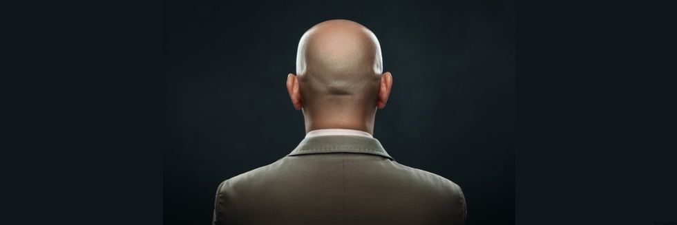 “Calling A Man Bald Is Sexual Harassment”: UK Employment Tribunal Rules